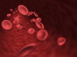 anemia sierpowata
